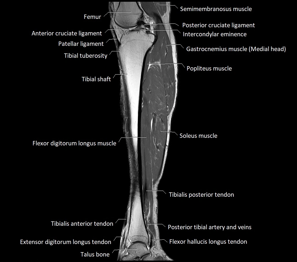 Lower leg sagittal anatomy 3T MRI image 20.webp